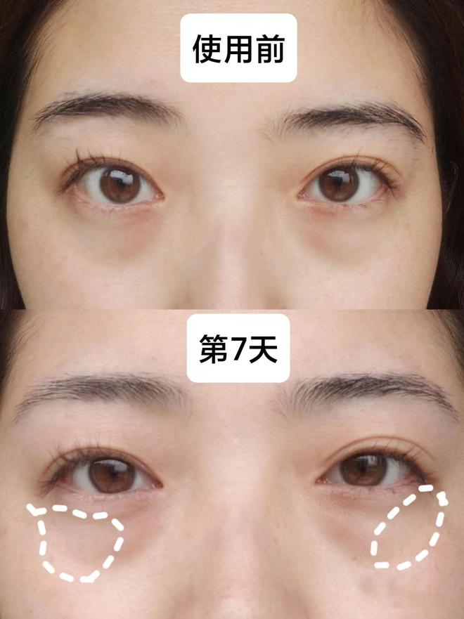眼袋哪个牌子好？秋冬眼霜上岸指南少走弯路凯发K8旗舰厅AG客服25岁男士眼霜去(图4)