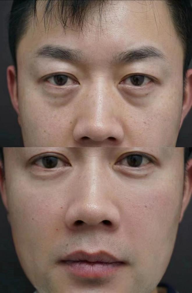 品推荐专业测评值得信赖凯发网址淡纹抗皱护肤(图1)