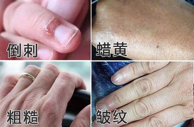 霜！跪求你买这8支好用到想报警！AG凯发K8国际冬日的第一支护手(图21)