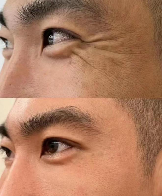 推荐这几款口碑不可错过凯发抗皱紧致的护肤品(图5)